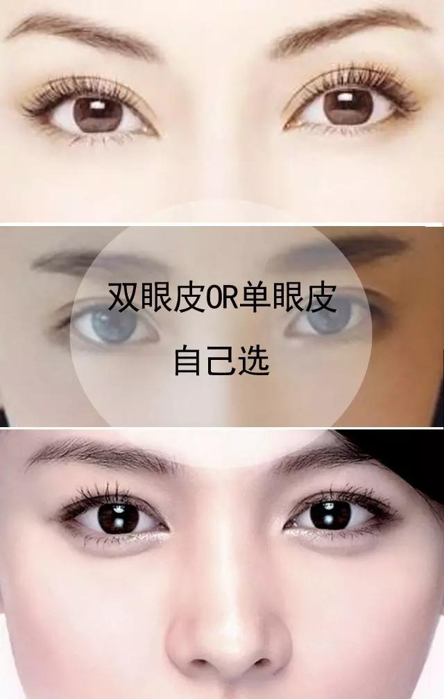 不建议做双眼皮的三种情况,为什么不建议做双眼皮
