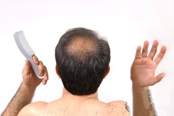 头皮痛而且脱发严重是怎么回事,头皮红起皮伴有脱发