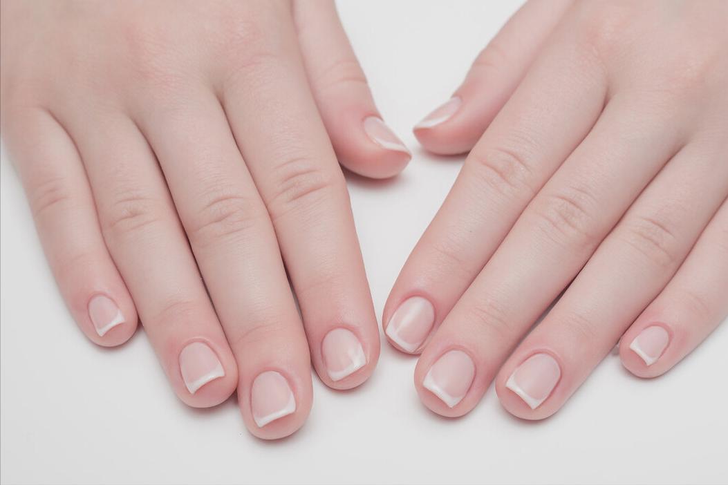 甲沟炎的倒刺要不要剪掉,手上的倒刺不长拔会得甲沟炎吗