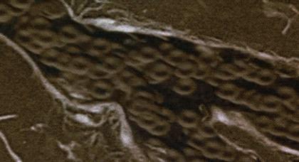 失眠很多年吃任何药都无效怎么办,失眠后背酸痛的原因