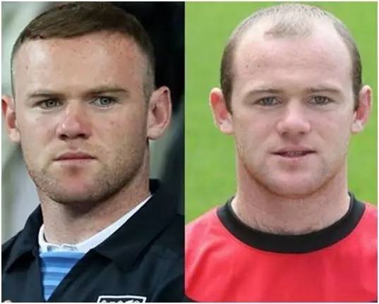 健身太猛会掉头发吗,为什么健身的男人秃头