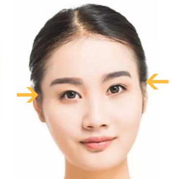 颧骨高面部填充好还是内推好,改善颧骨宽大