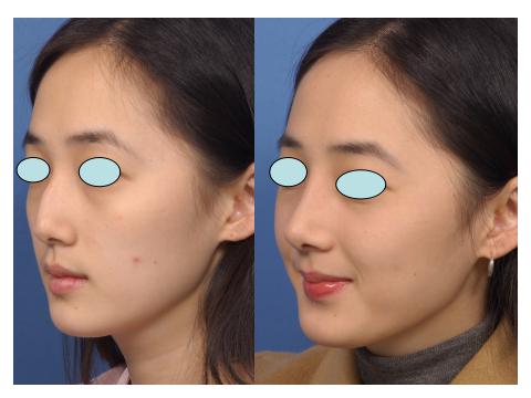 韩国BDK国际专科联盟专家团坐诊深圳希思