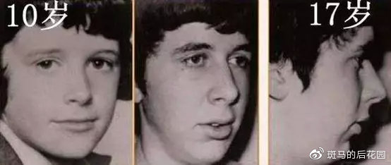 腺样体肥大对长大有什么影响,腺样体长大就萎缩害了多少孩子