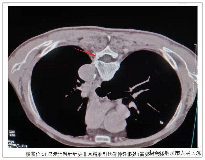 市人民医院医学影像科,德州市人民医院微创介入中心