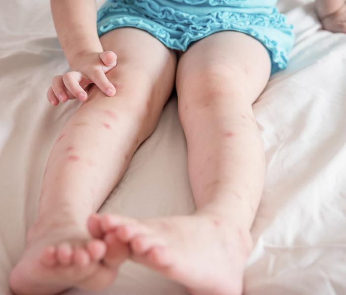 换季了孩子皮肤干燥怎样护理,儿童秋季皮肤干燥发痒怎么办