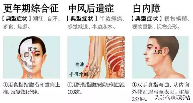 18种常见病特效药,88个特效穴位治疗常见病集锦
