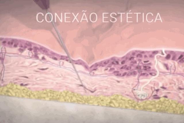 正确认识一下玻尿酸到底有啥功效,请收好这篇玻尿酸全面科普文章