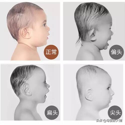 新生婴儿如何避免先天性疾病,天使宝宝的症状有哪些