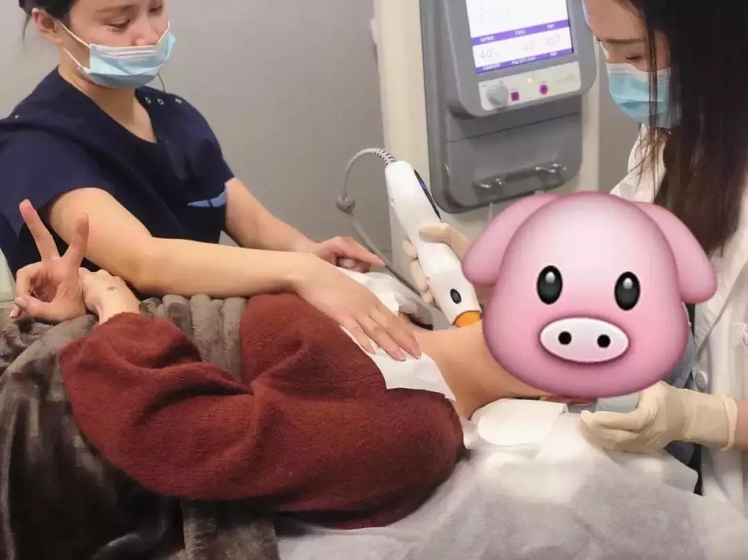 目前去颈纹比较好的方法,去颈纹有没有什么好的产品