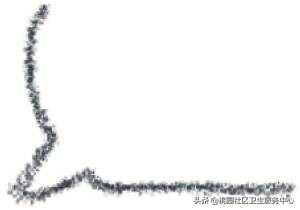 关于水痘高发期的注意事项,水痘的坑怎么消