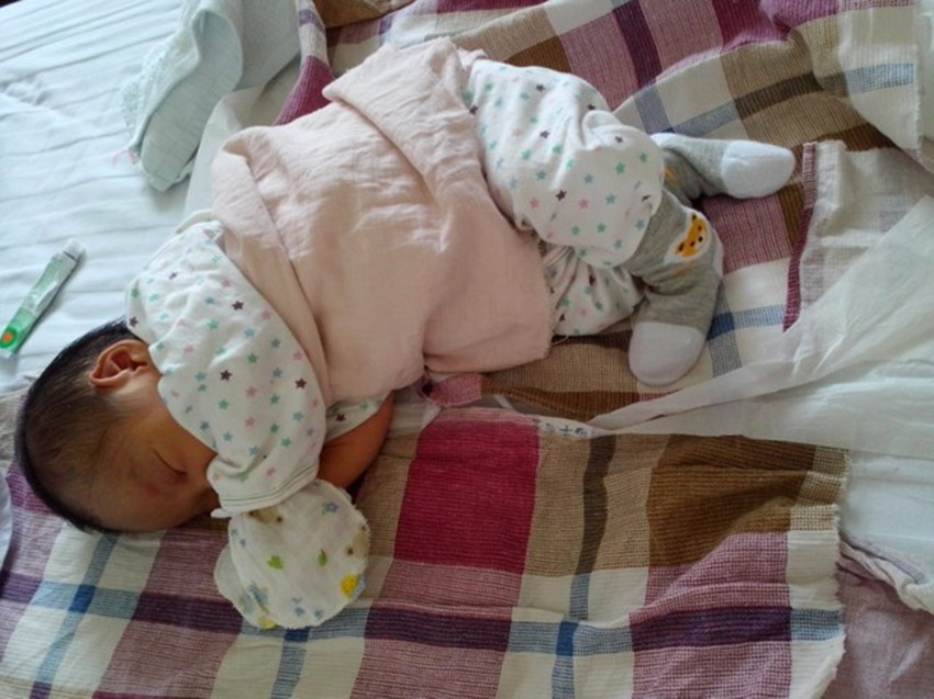 宝宝骨关节活动有响声,宝宝左侧额骨骨折怎么办