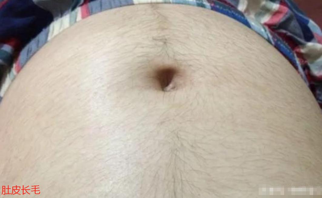 准妈妈孕期肚皮上为什么会长毛？老人说怀的男宝，真的是这样吗？