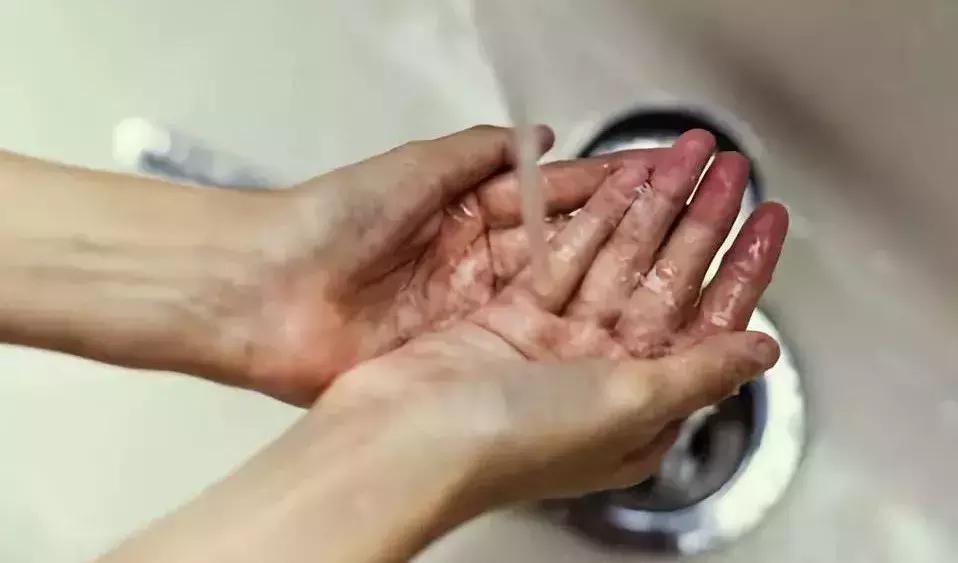 人体的五个部位不需要干净,身体6个部位太干净容易生病