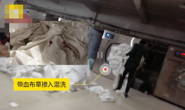 睡酒店的床单身体痒擦什么,住酒店床单清洁不到位皮肤过敏