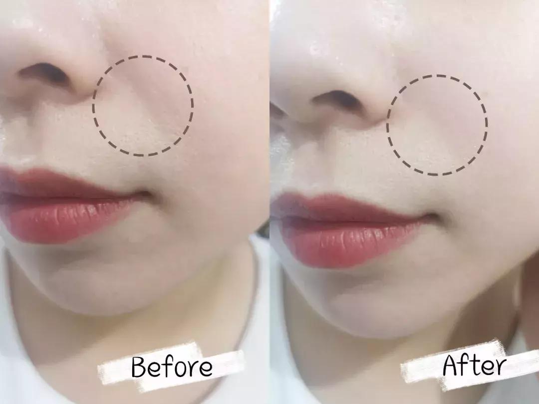 资生堂抗皱小雷达测评,资生堂抗皱小雷达小样