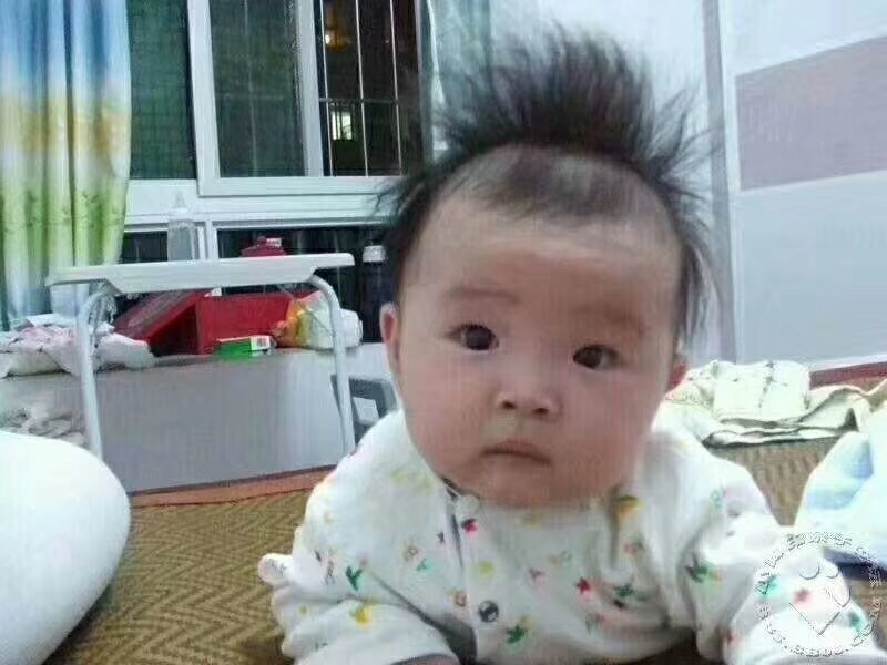 妈妈爸爸:我的头发竖着长您知道怎么了吗?