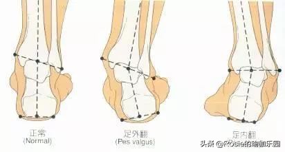 瑜伽高足弓的激活方法,建立足弓的瑜伽动作