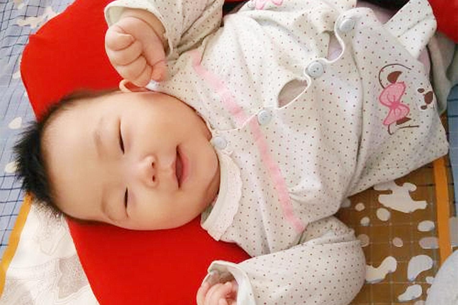 宝宝淹脖子油越擦越严重,宝宝淹脖子了旁边都有红点点