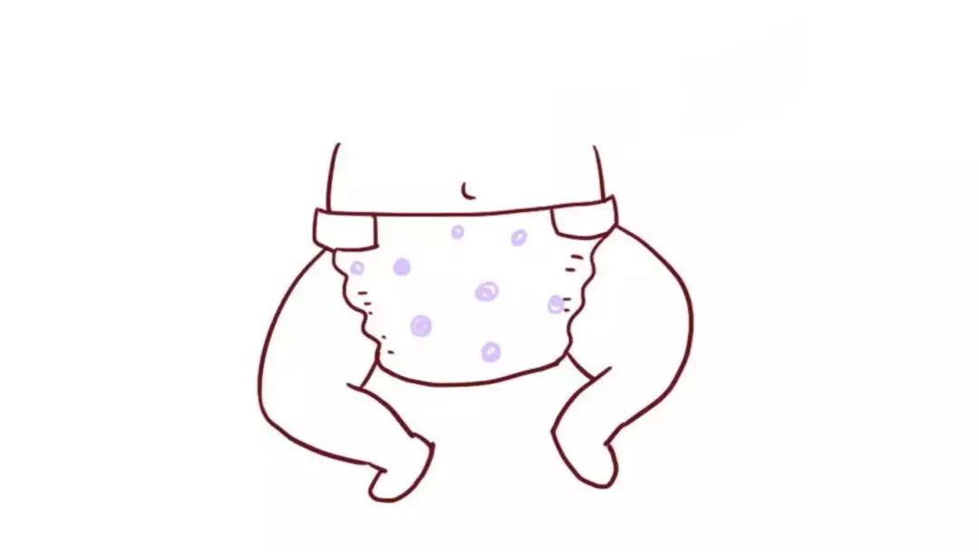 宝宝尿不湿换晚了屁股很红,宝宝换尿不湿正确方法新手