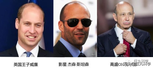 日本一个教授研究秃头30年，得出的结论有点耿直过头了