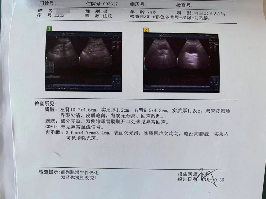 从正常发展到尿毒症要多久,开始肾病到死亡有多长时间