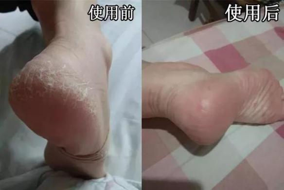 手模怎么护手的,手膜怎么护手视频教程