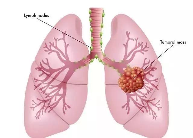 肺有点不舒服就要咳嗽是什么原因,如果肺上有疾病有什么反应