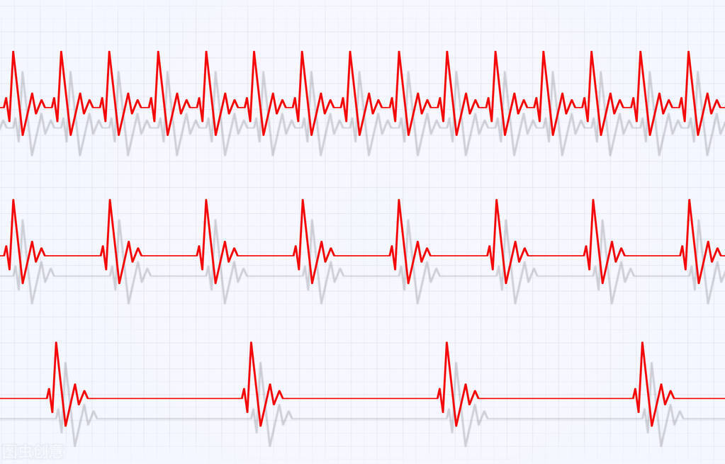 心动过速有什么中成药治疗,心动过速的预防