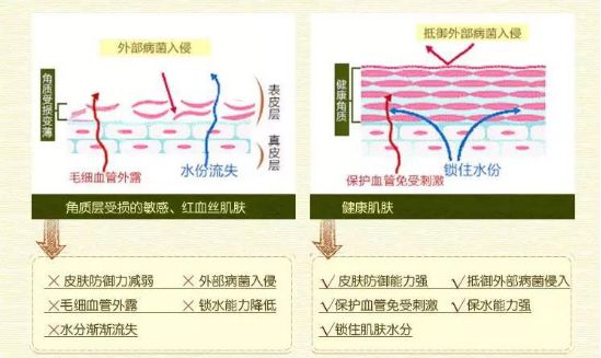 角质层薄适合的水,角质层过薄怎么办有什么方法