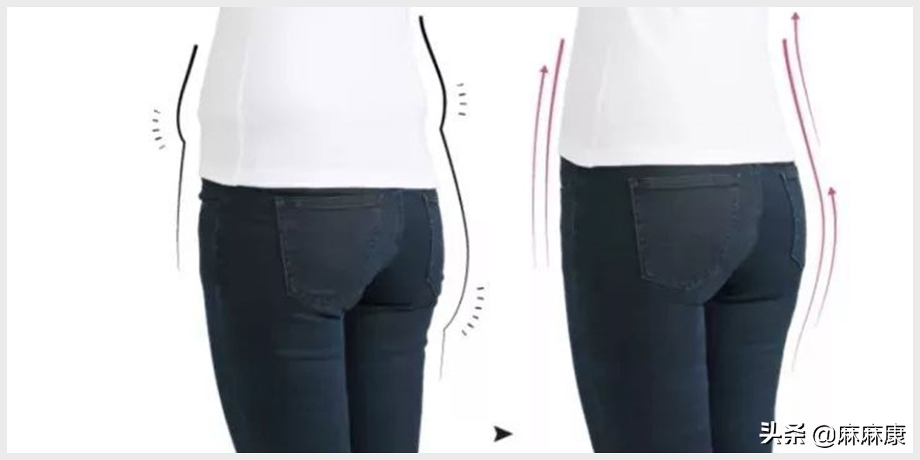 怎么改善产后假胯,消除产后假胯宽