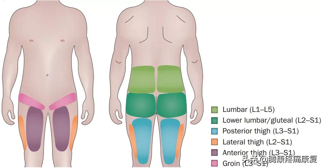 反射痛和牵涉痛,牵涉痛的特点