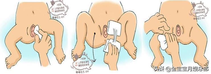 如何做臀部护理视频,臀部注射法护理操作