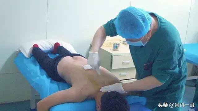 强直6年绝望自杀！在家人逼迫下，做出选择，竟然驼背也挺直了