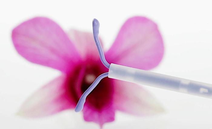 女人上了节育环会出现宫外孕吗,女人上了节育环