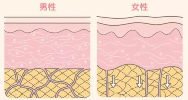 瘦下来橘皮会消失吗,橘皮组织肥胖怎么办