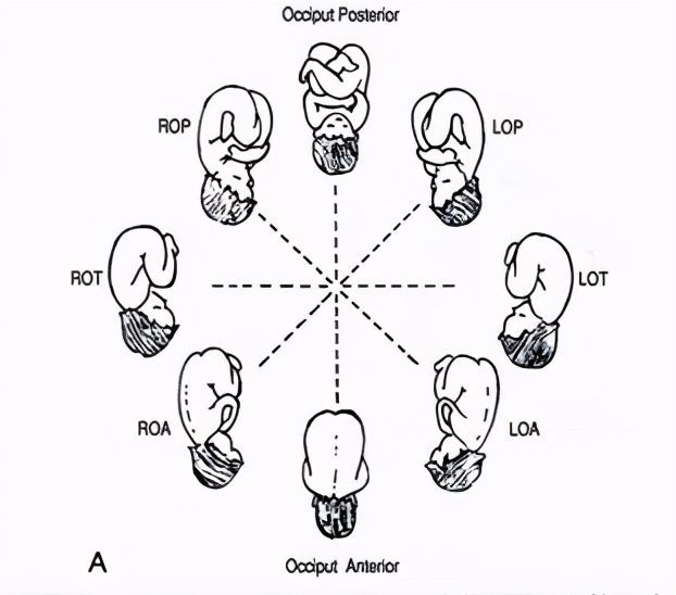 胎儿在子宫的体位,胎儿在子宫右边应该怎么睡觉姿势