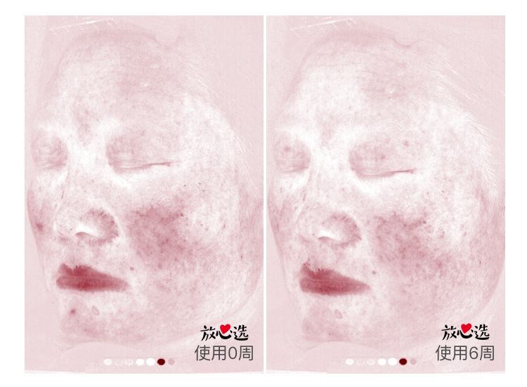 雅诗兰黛15毫升小棕瓶,雅诗兰黛小棕瓶精华100ml日上540元