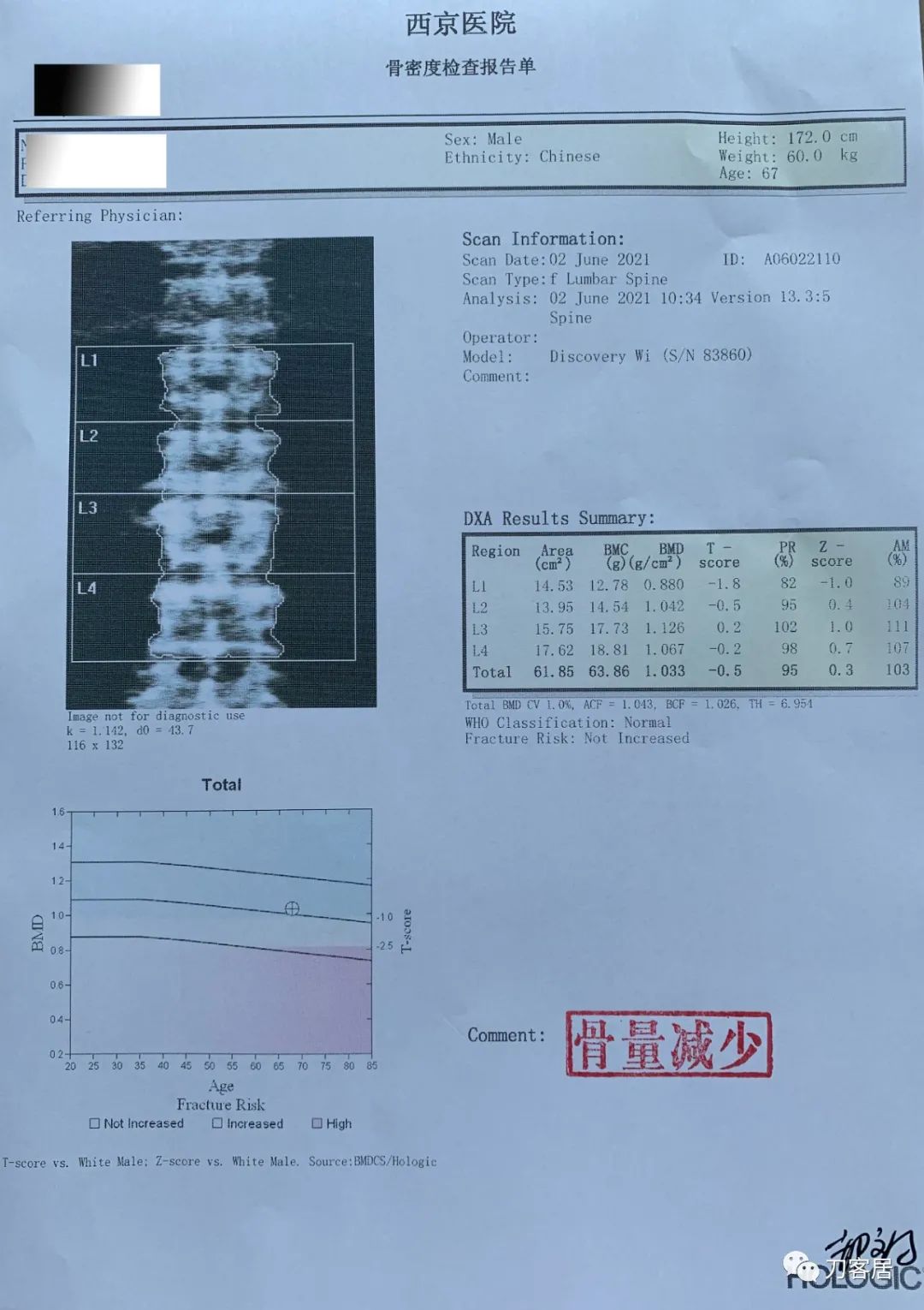 颈椎病椎间盘突出医生说先不手术,颈椎3-7节椎间盘突出怎么治疗