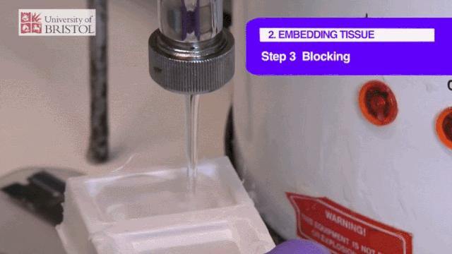 病理报告为什么这么慢,手术后病理报告准确率高吗