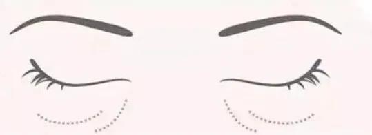 假期提示|放假熬夜冠军又要来了，黑眼圈到底怎么来的心里没点数吗？