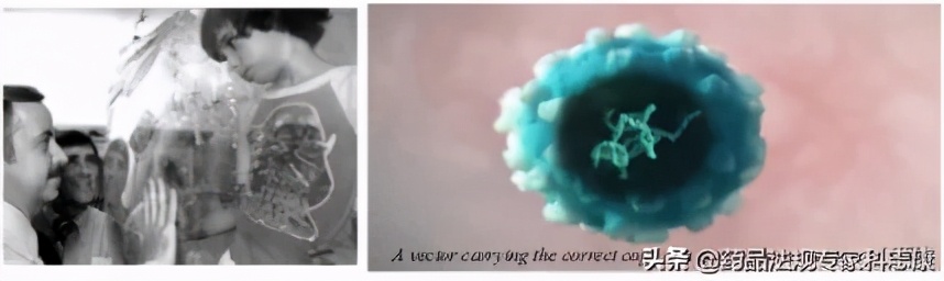 基因疗法的安全性Strimvelis被怀疑导致一名患者白血病