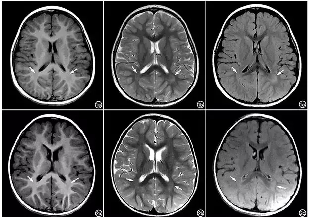 小孩子说话不清楚说话鼻音很重,孩子听不懂说话不会说话什么原因
