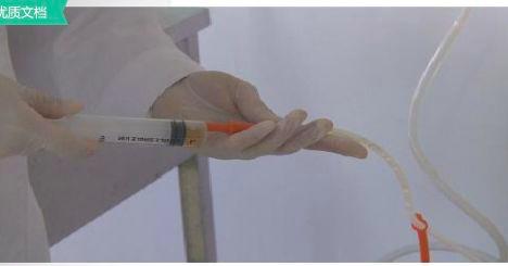 留置胃管的护理记录怎么写,出院后胃管护理宣教