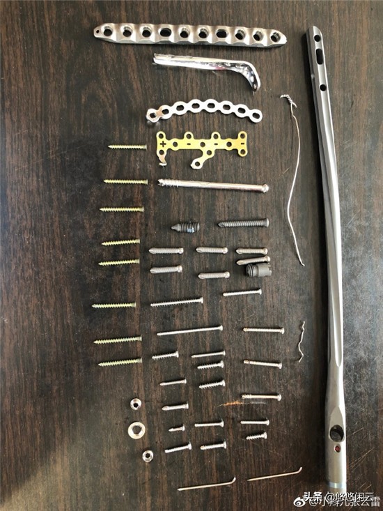 董九力说张云雷钢钉出来是哪一场,张云雷脚上钢钉露出时表演原视频