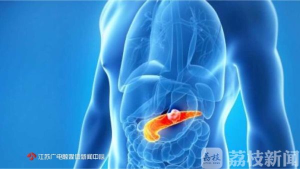 经常拉肚未必是肠胃炎！这种罕见病带走了“苹果之父”乔布斯