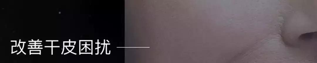 酵母肌底液有什么作用,虾青素肌底液的功效与作用