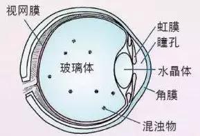 眼前一直有蚊子是什么病,眼前总有蚊子飞怎么治呀