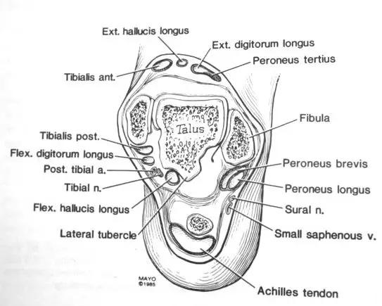 踝关节撞击症问诊,踝关节撞击综合征的x线表现