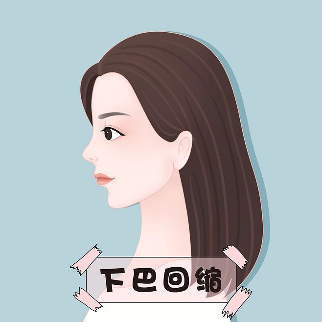 下巴上翘显得脸方,下巴往前翘而且饱满